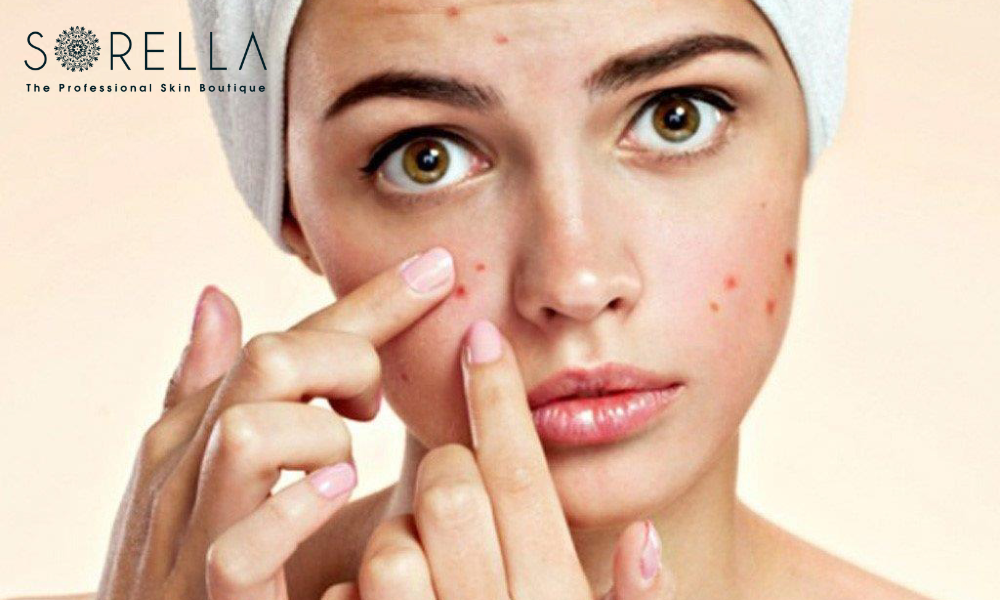 Make scars less noticeable