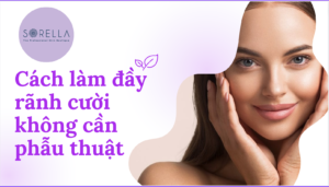 Cách làm đầy rãnh cười không cần phẫu thuật