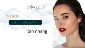 Cách điều trị đốm tàn nhang