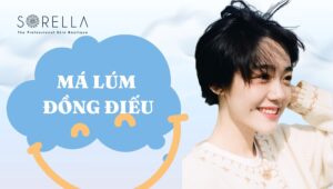 má lúm đồng điếu