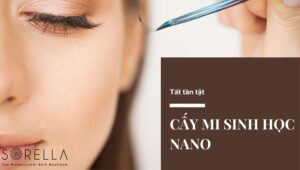 cấy mi sinh học