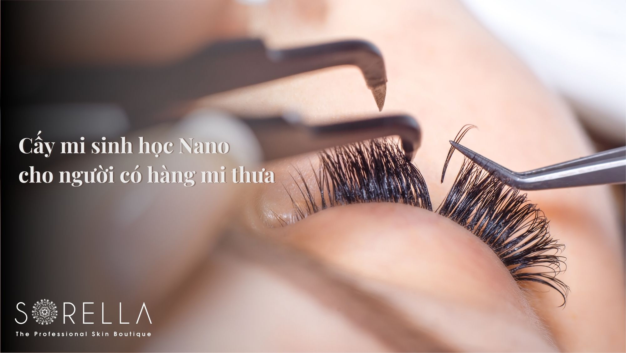 cấy mi sinh học