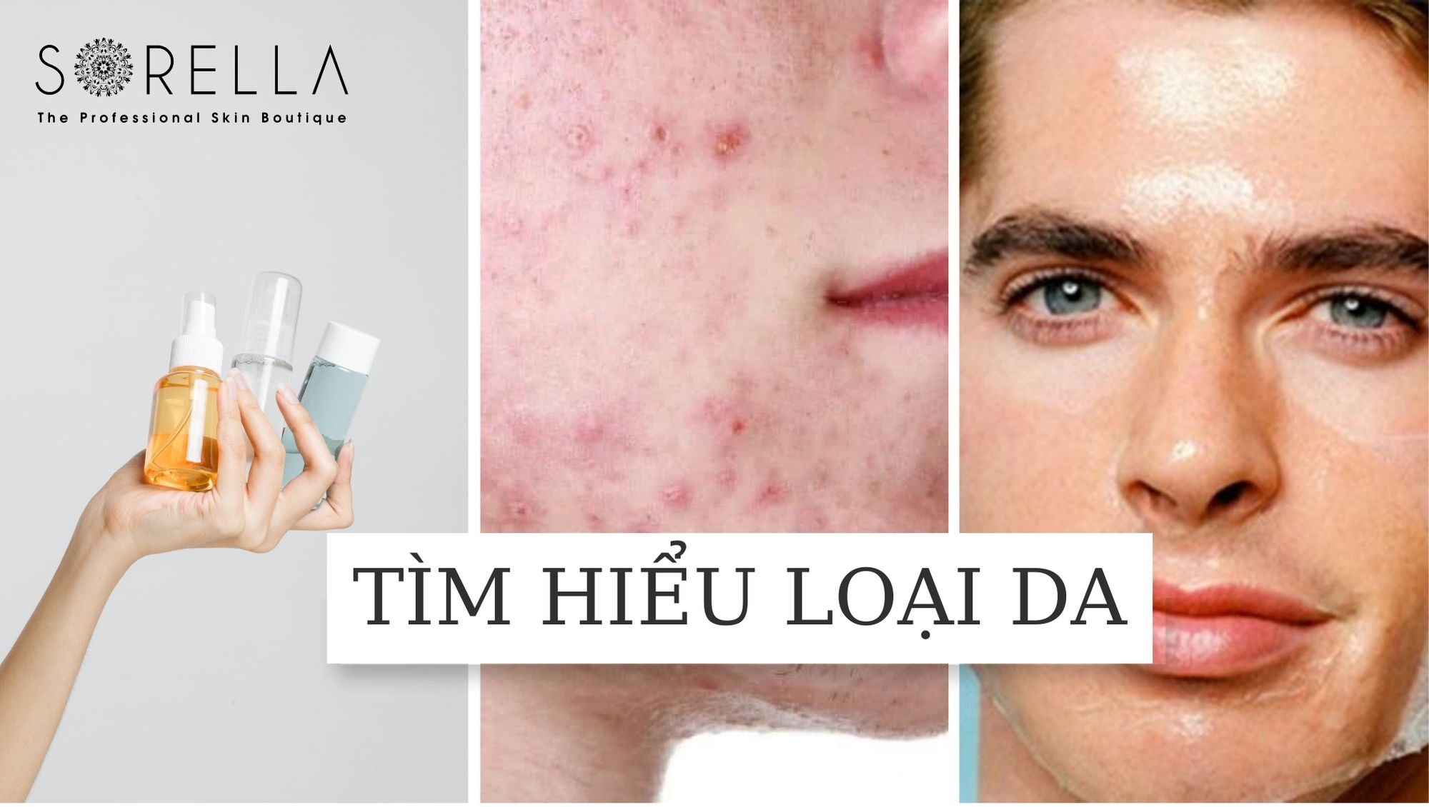 Nam giới có cần chăm sóc da không?