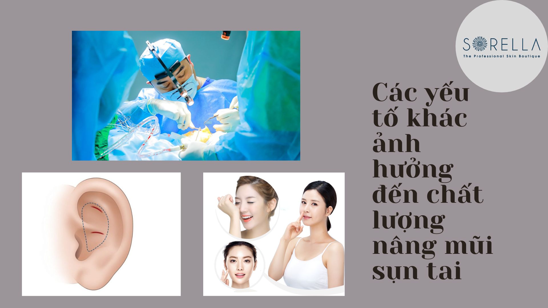Nâng mũi bọc sụn tai có vĩnh viễn không?