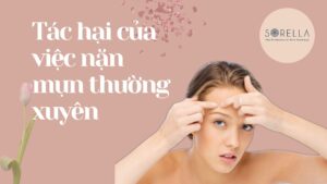 Tác hại của việc nặn mụn thường xuyên