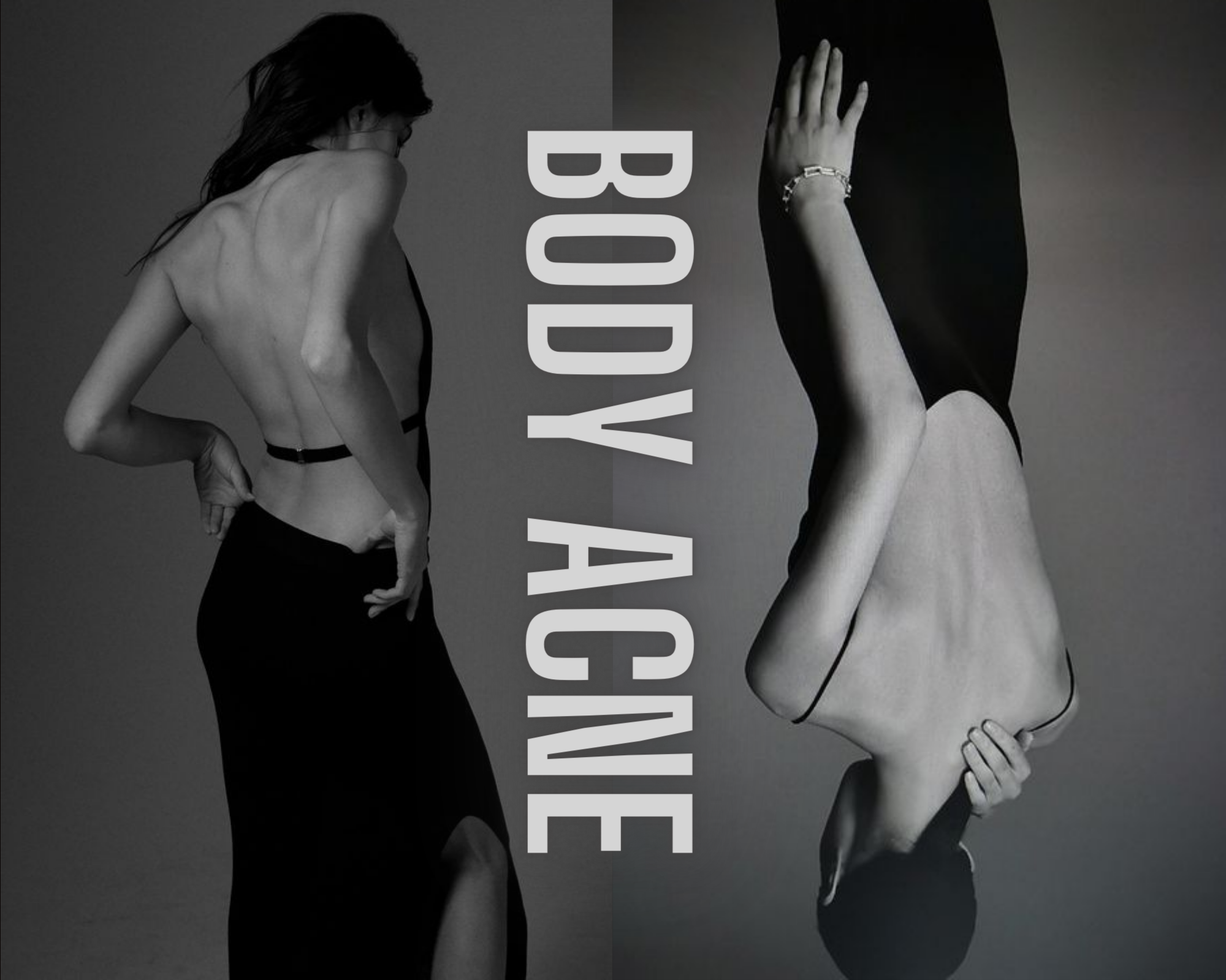 Treatment for Back and Body Acne