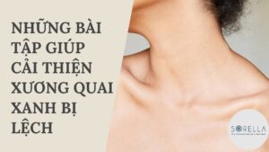 Xương quai xanh bị lệch