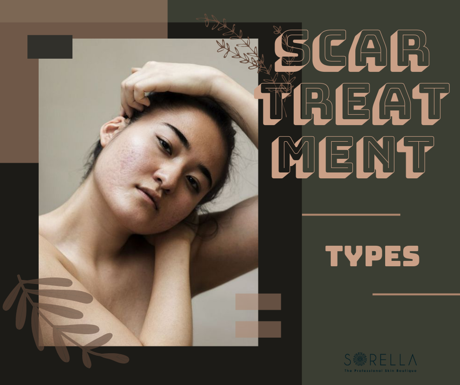 Scar categorization is often used