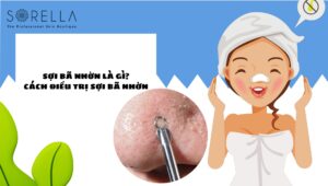 sợi bã nhờn