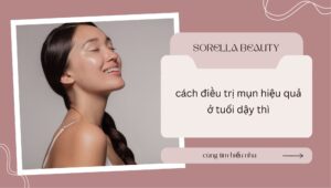 cách điều trị mụn