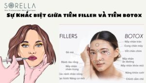 tiêm filler và botox