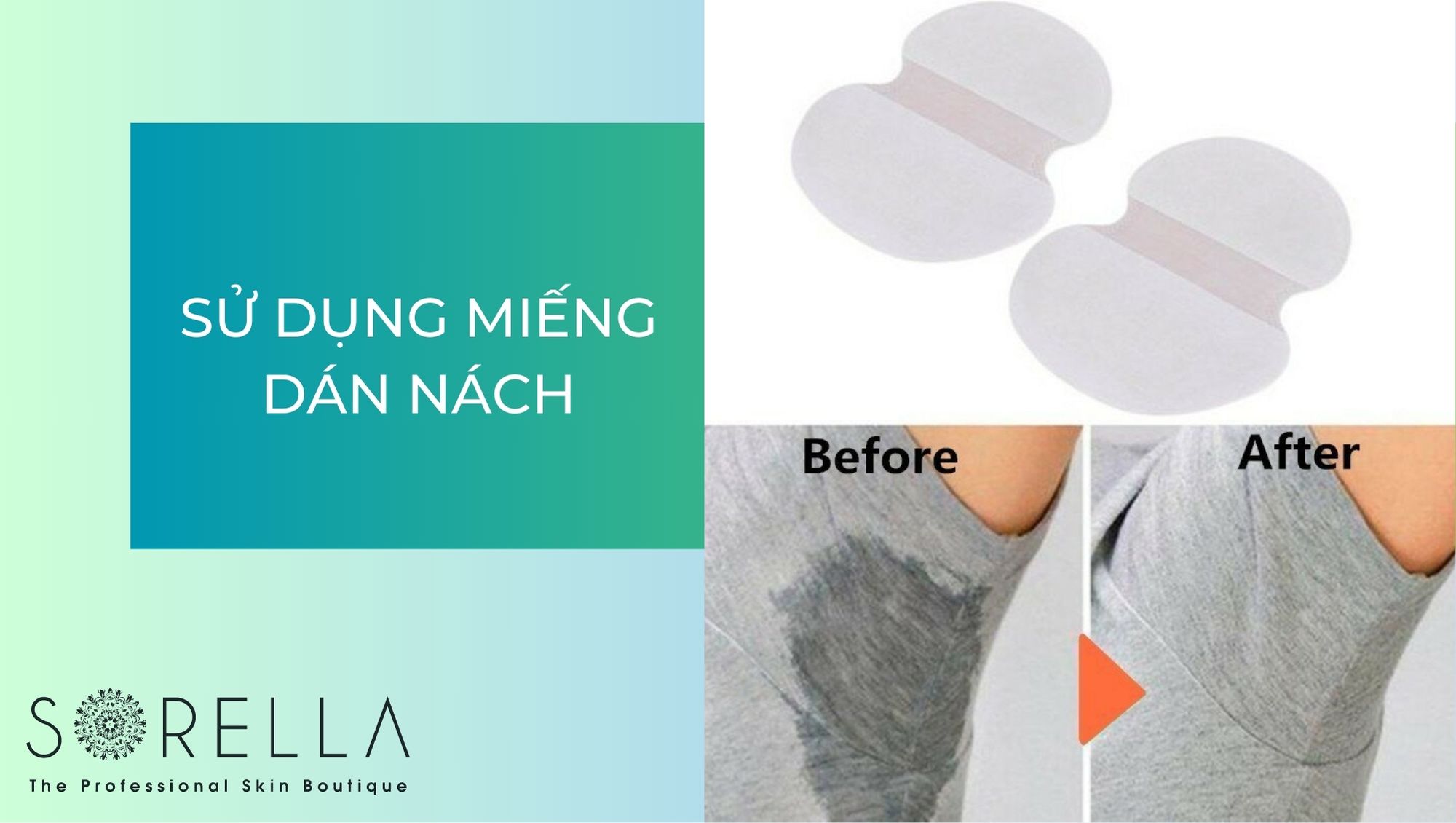 Cách ngăn mồ hôi nách