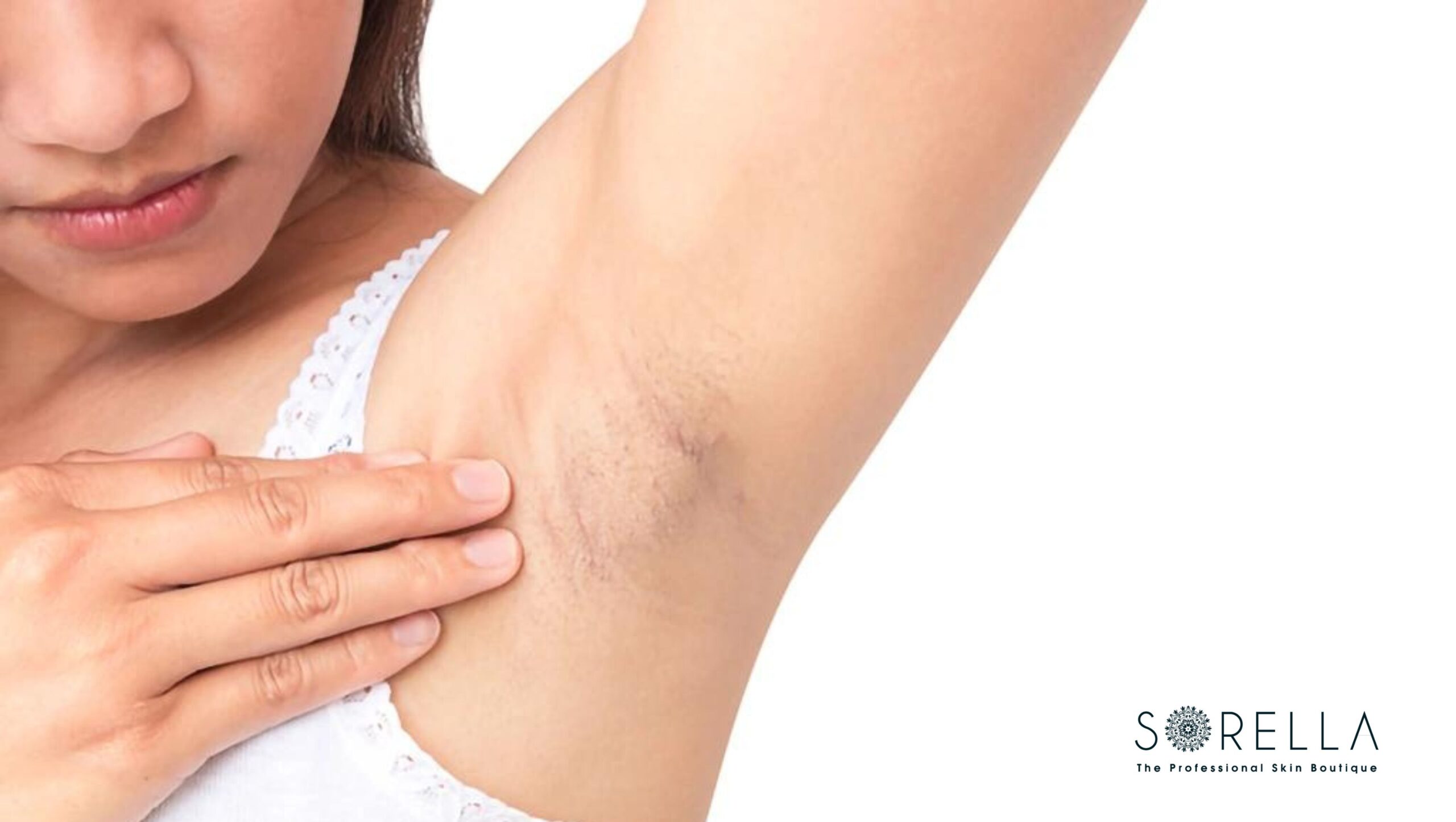 Không giống như nam giới, lông nách lại là một yếu tố khiến các bạn gái rất mất tự tin.