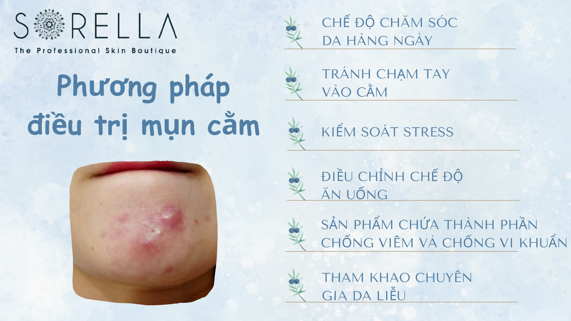 Phương pháp điều trị mụn cằm