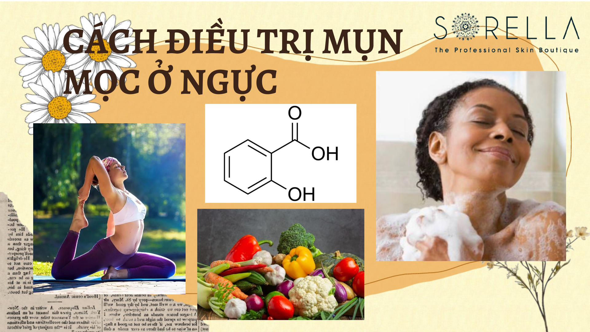Cách điều trị mụn mọc ở ngực