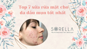 Top 7 sữa rửa mặt cho da dầu mụn tốt nhất