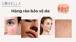 Hàng rào bảo vệ da
