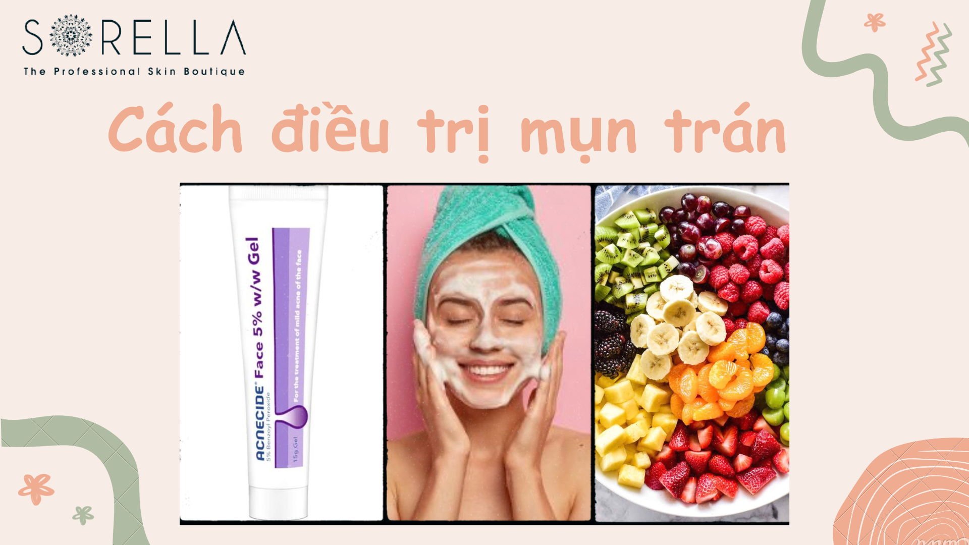 Các điều trị mụn trán