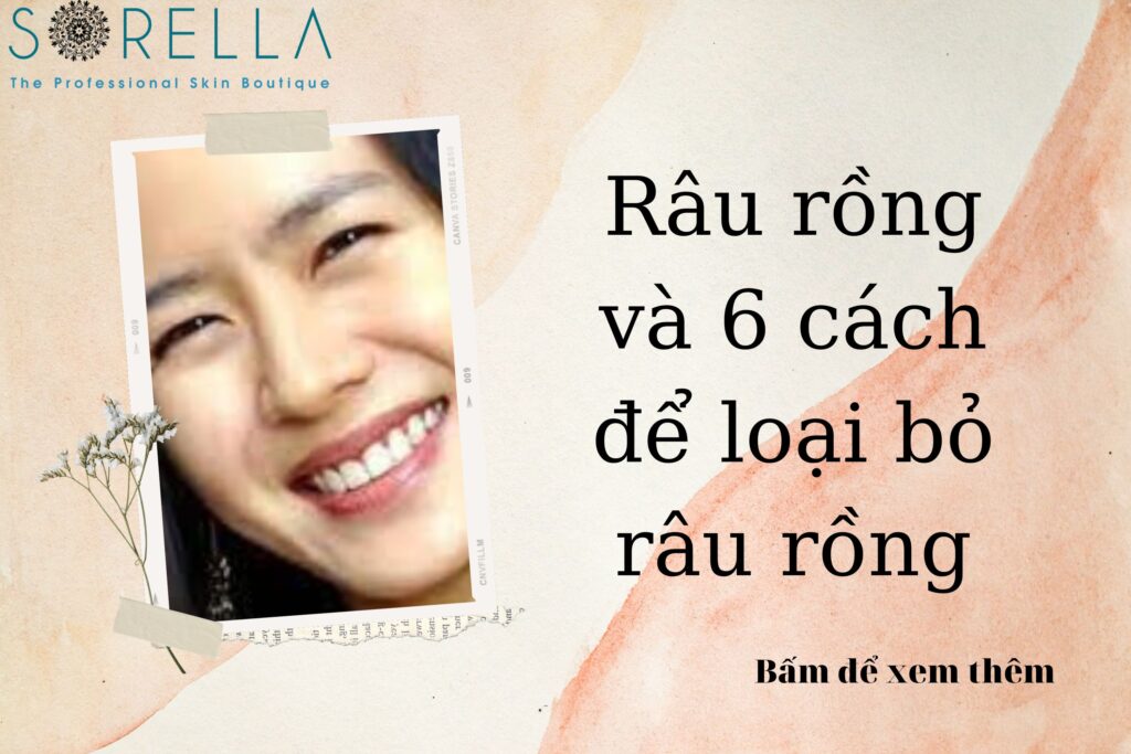 râu rồng