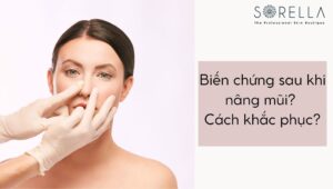 những biến chứng
