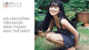 của má lúm đồng tiền
