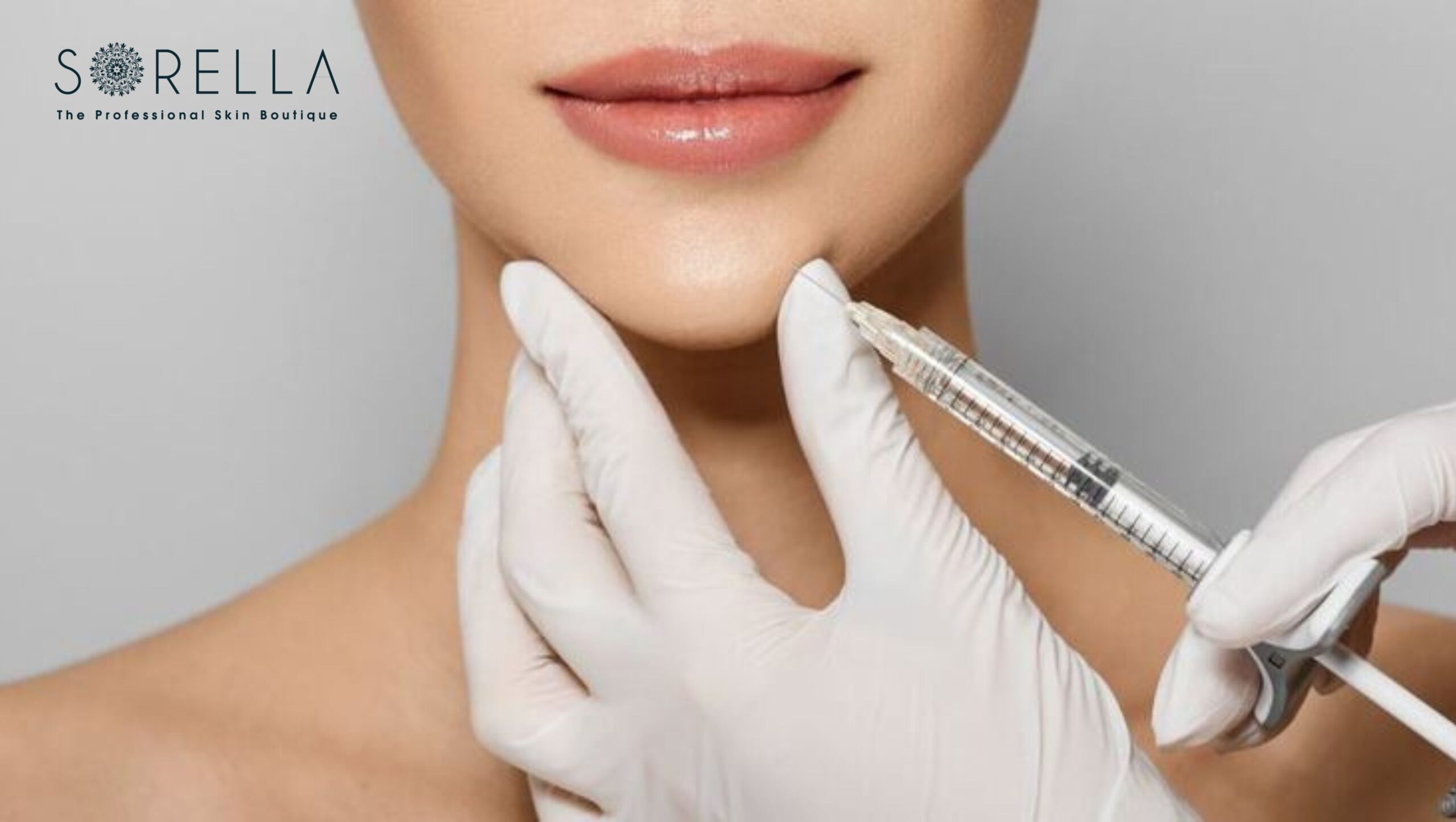 Tiêm filler cằm