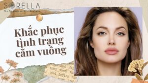 Khắc phục tình trạng cằm vuông