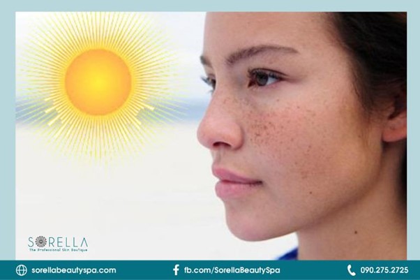 Hạn chế tiếp xúc trực tiếp với ánh nắng mặt trời