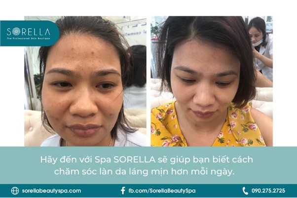 Địa chỉ chăm sóc da uy tín - SPA SORELLA