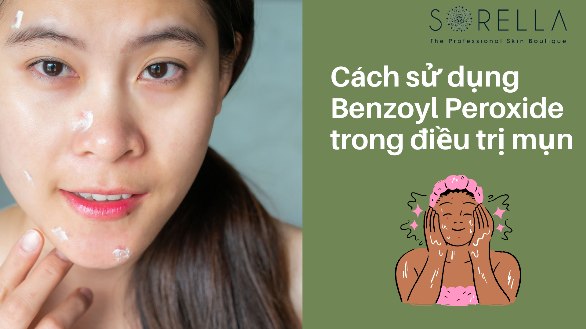 Cách sử dụng Benzoyl Peroxide trong điều trị mụn