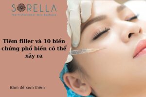 Tiêm fillerhttps://new.sorellabeautyspa.com/?p=8772&preview=true