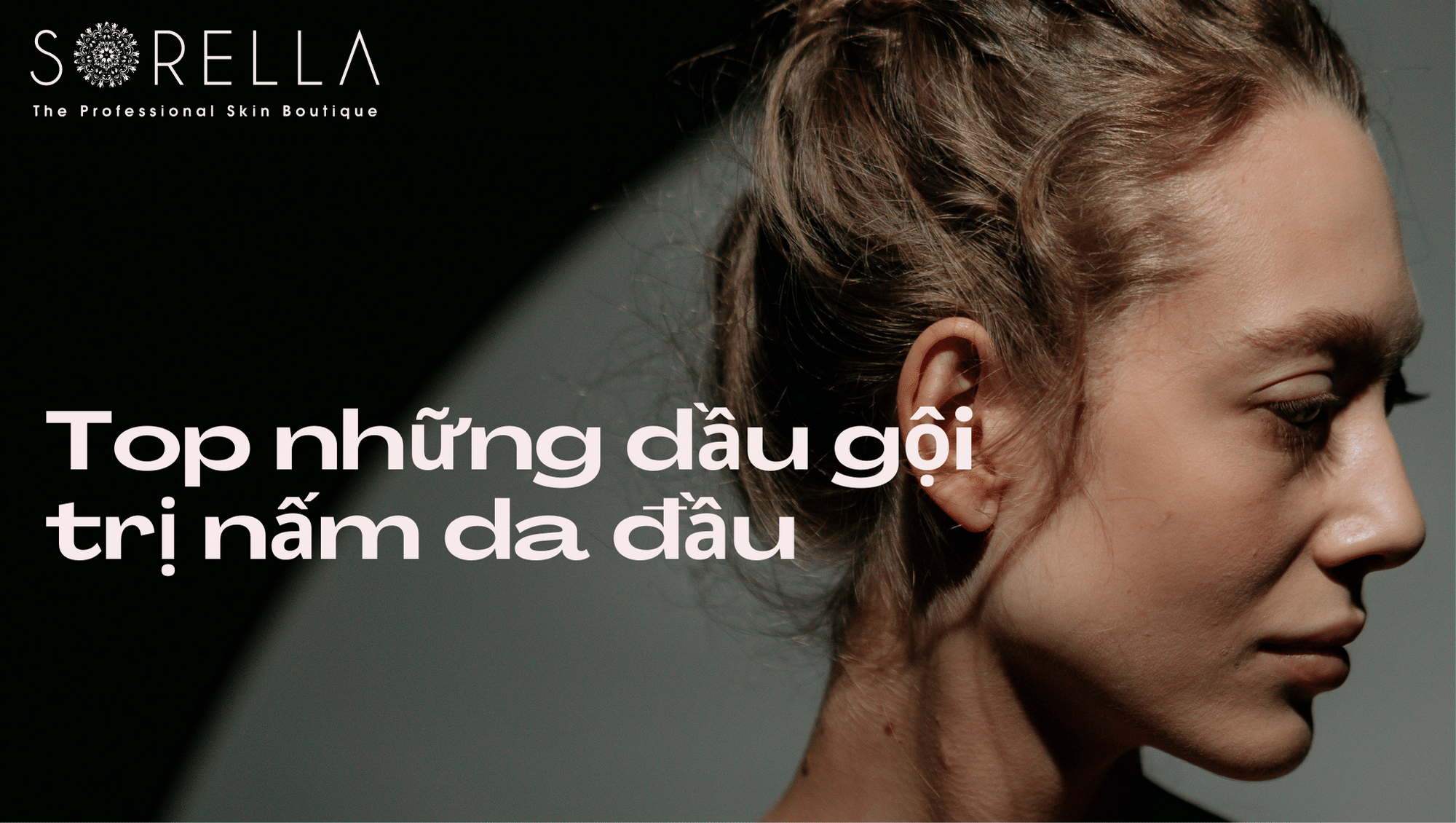 dầu gội trị nấm da đầu