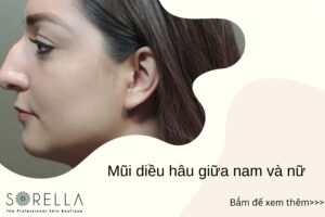 Mũi diều hâu