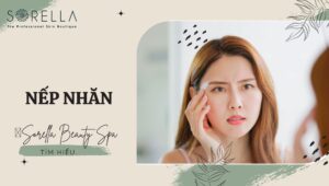 nếp nhăn