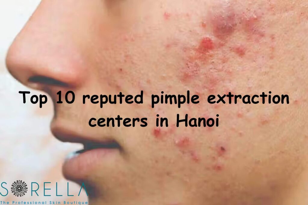 https://new.sorellabeautyspa.com/?p=10770&preview=true