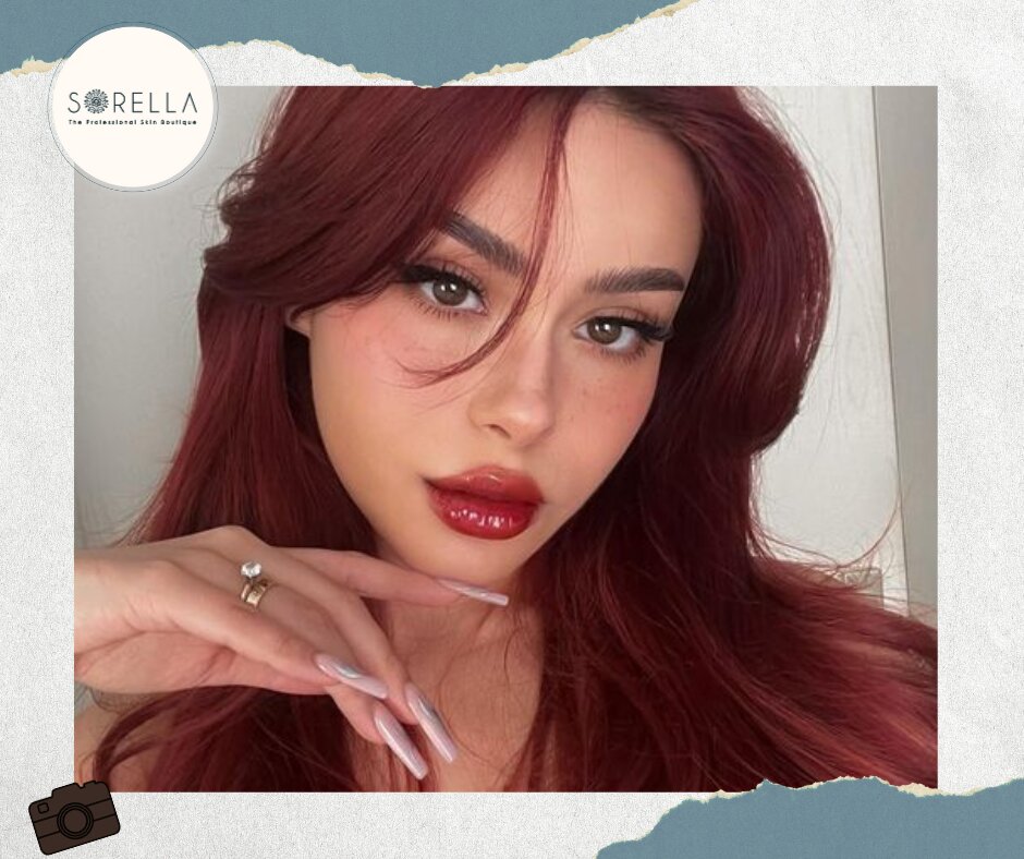 Hot Trend Lip Filler Styles