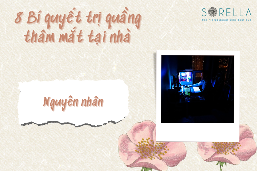 3 Lý do tại sao giới trẻ hiện nay hay có quầng thâm mắt