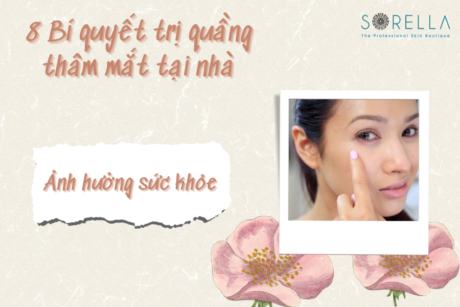 2 Quầng thâm mắt có gây hại cho sức khỏe hay không