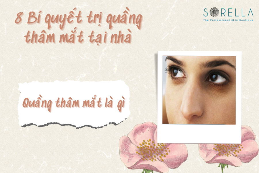 1 Quầng thâm mắt là gì