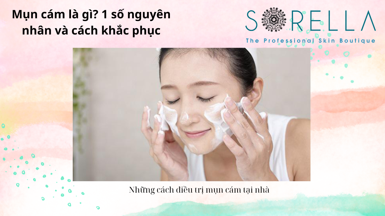 Mụn cám là gì?