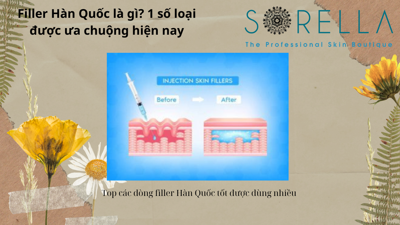 Filler Hàn Quốc là gì?