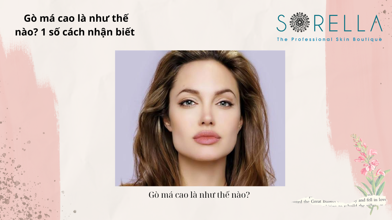 Gò má cao là như thế nào?
