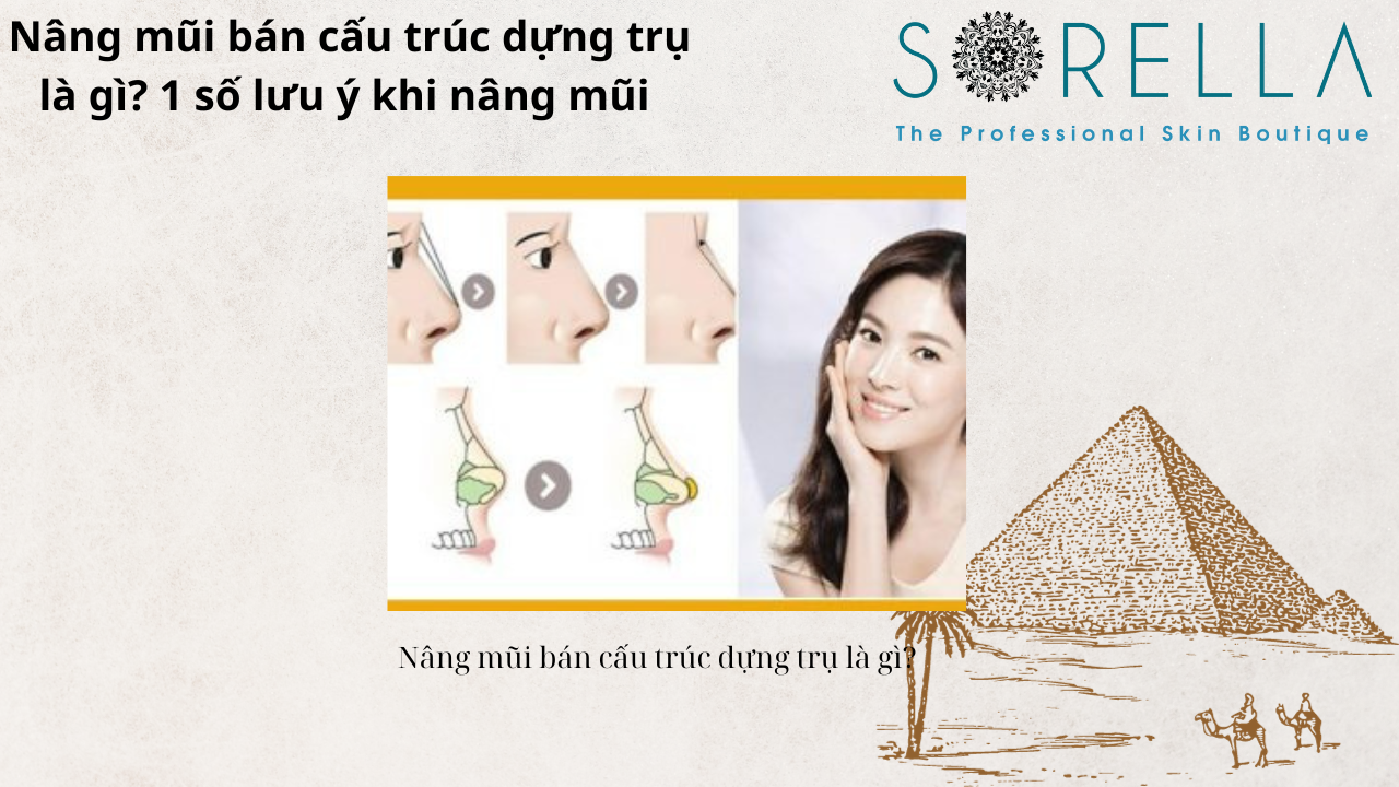 Nâng mũi bán cấu trúc dựng trụ là gì?