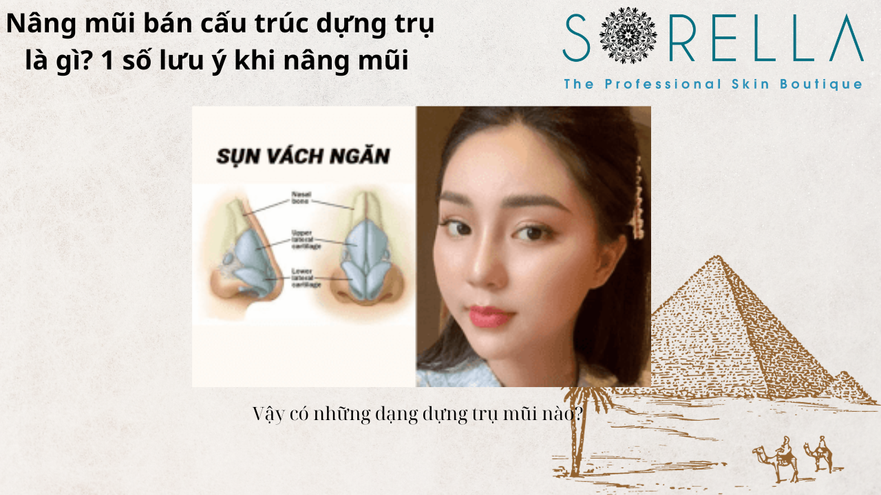 Nâng mũi bán cấu trúc dựng trụ là gì?