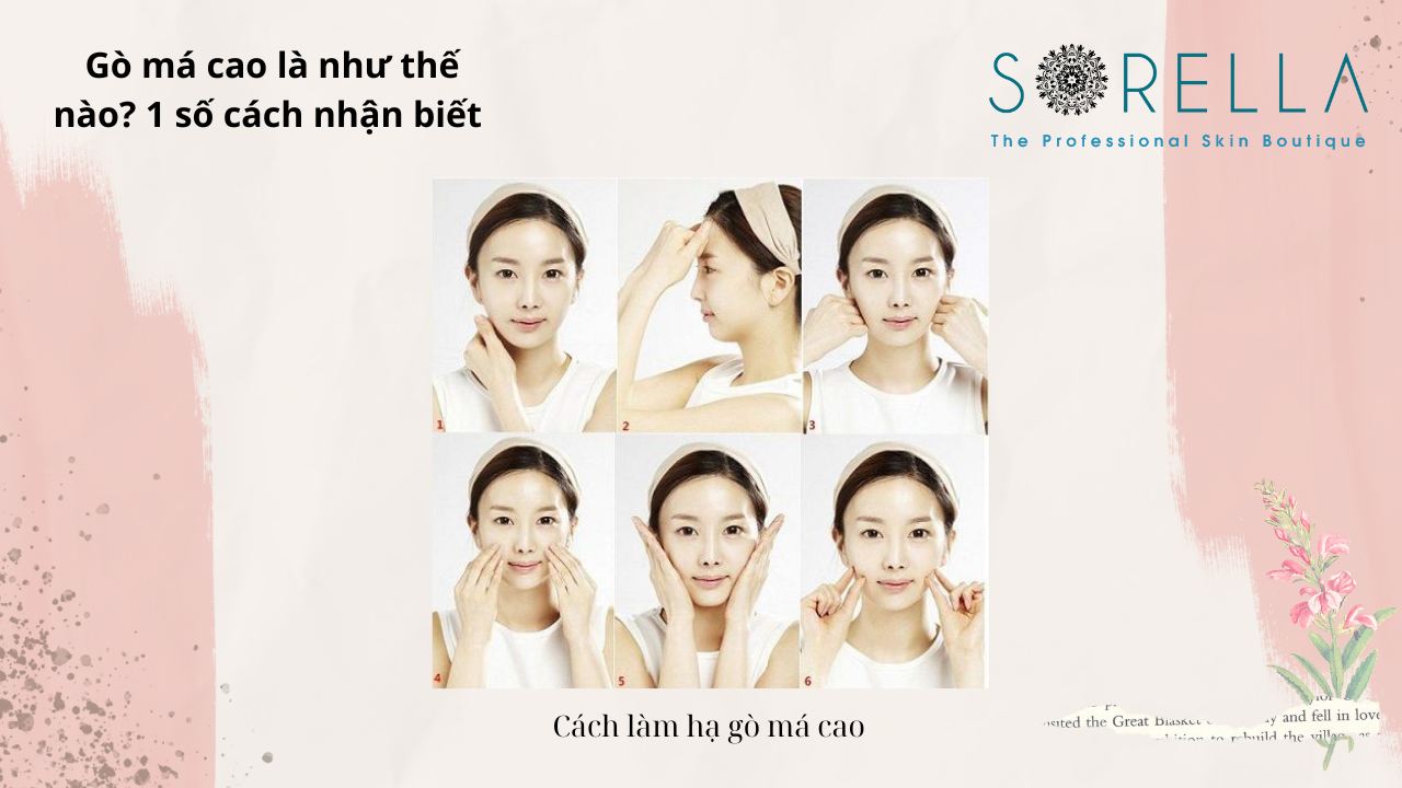 Gò má cao là như thế nào?