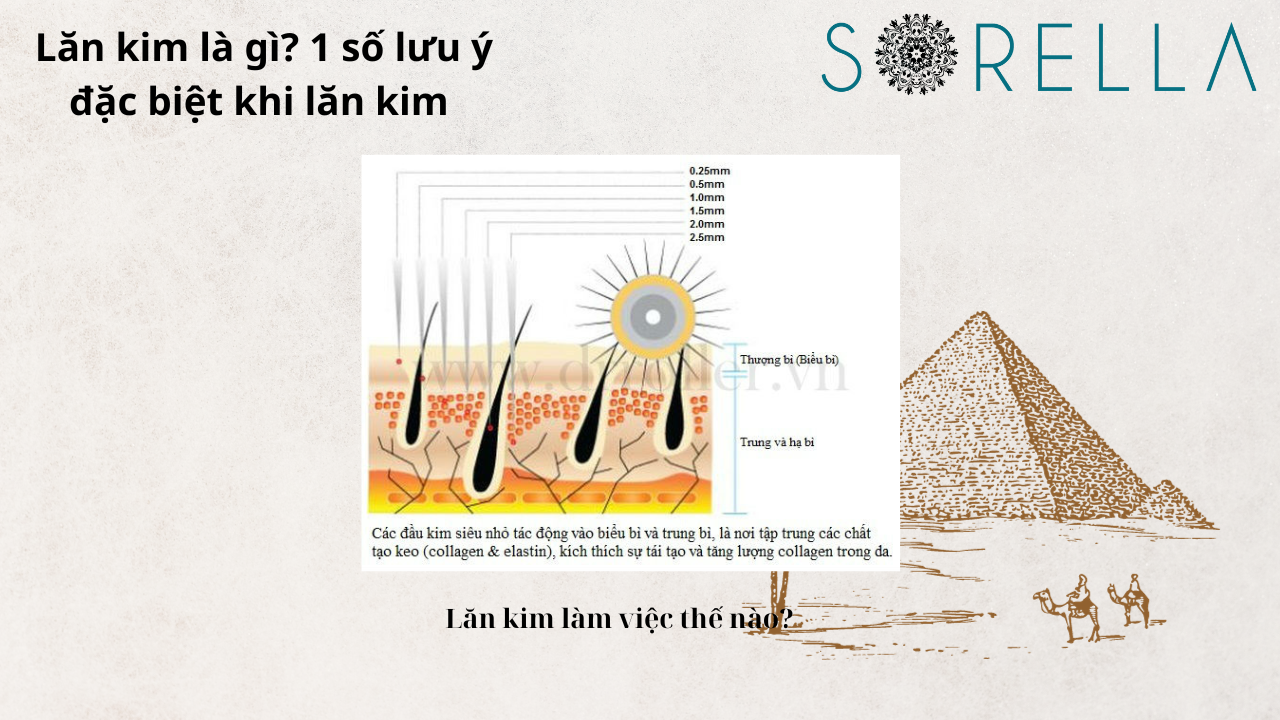 Lăn kim là gì?