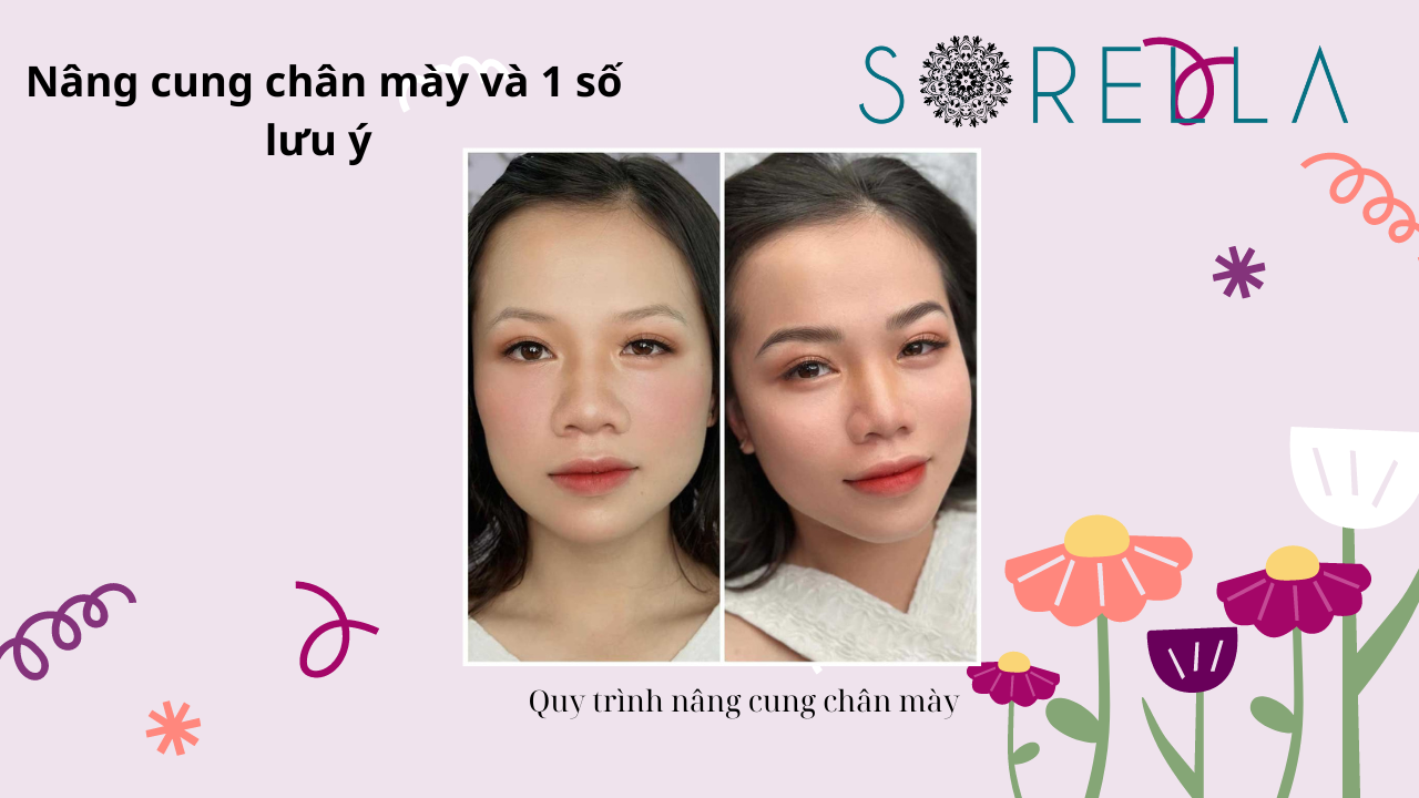 Nâng cung chân mày là như thế nào