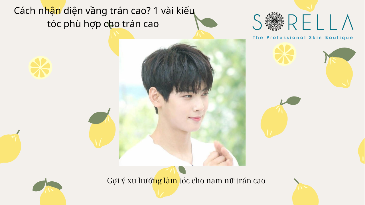 Cách nhận diện vầng trán cao?