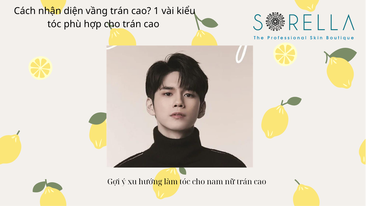 Cách nhận diện vầng trán cao?