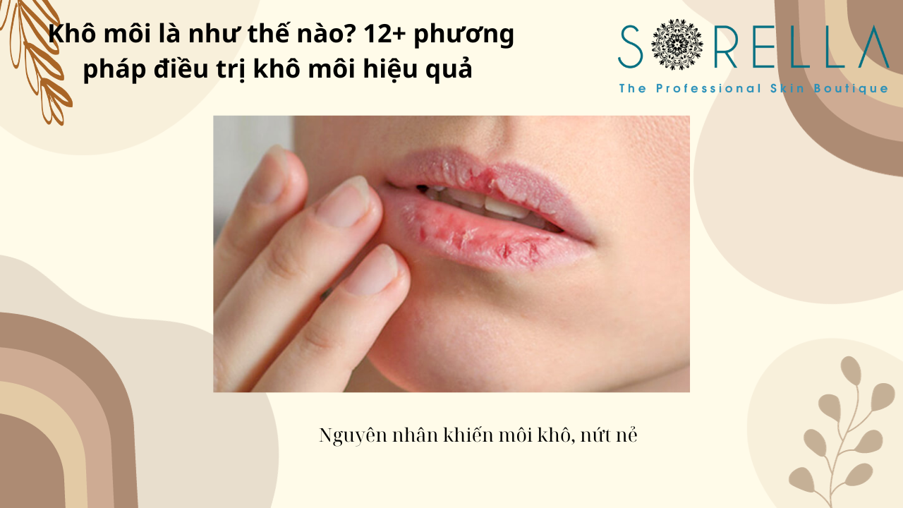 Khô môi là như thế nào?